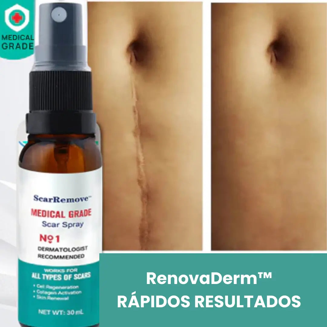 RenovaDerm™: Spray para cicatrices + Envío GRATIS