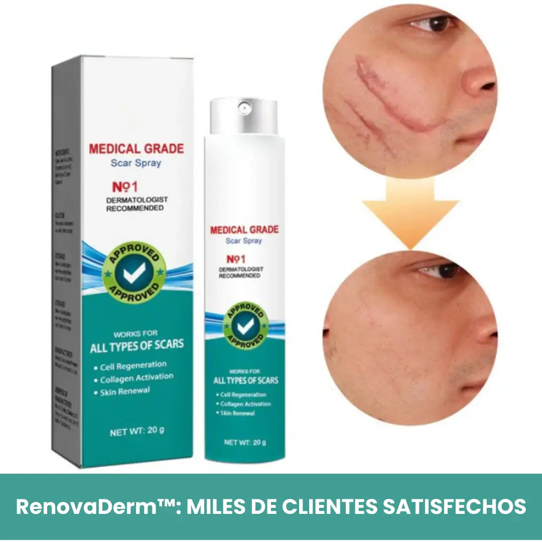 RenovaDerm™: Spray para cicatrices + Envío GRATIS
