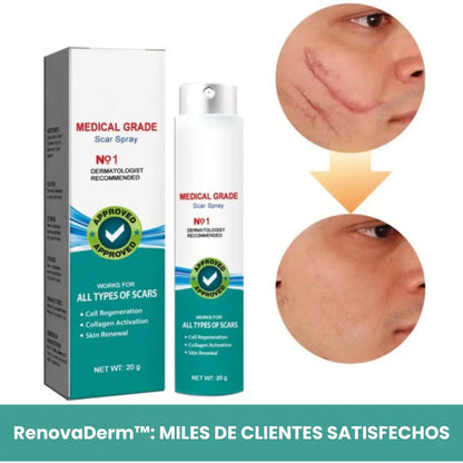 RenovaDerm™: Spray para cicatrices + Envío GRATIS