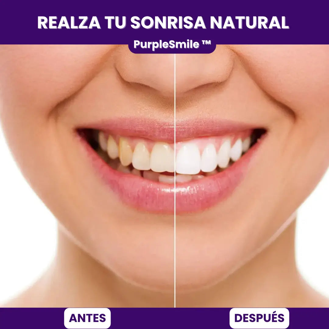 ¡NUEVO! PurpleSmile ™ + Envío GRATIS